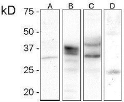 Rabbit anti-Prion protein, Clone: V21-V, Novus Biologicals 0.05mL; Unlabeled:Antibodies,